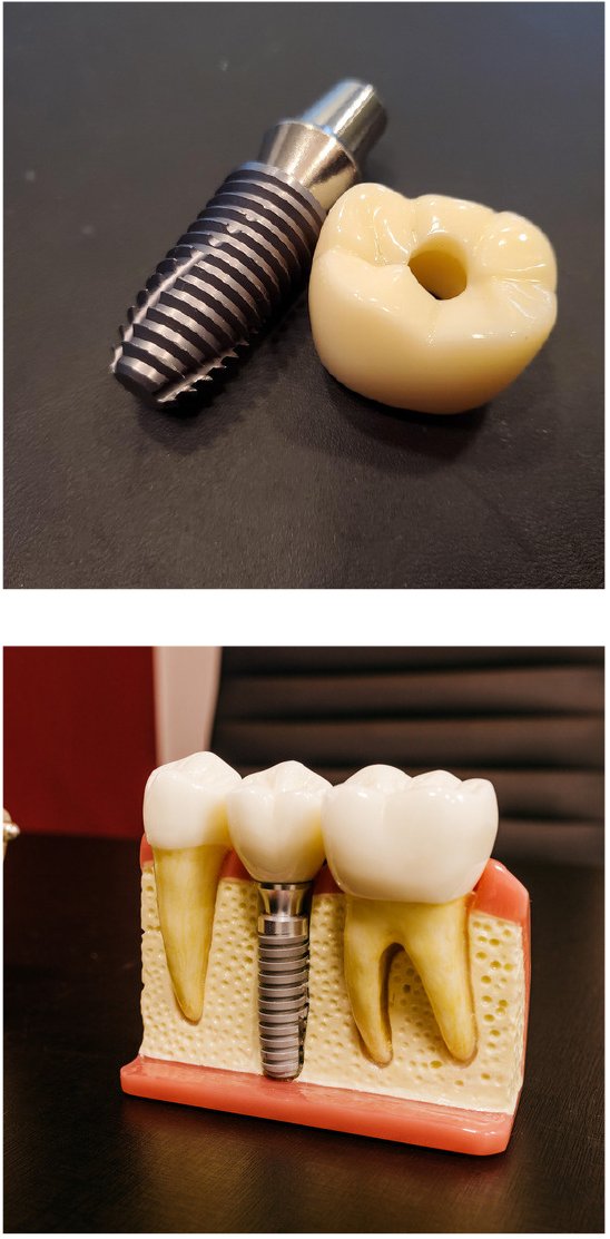 Hollywood Smile au Maroc